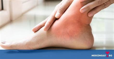 Симптоми, диагностика и лечение на ревматоиден артрит — MedConsult.bg