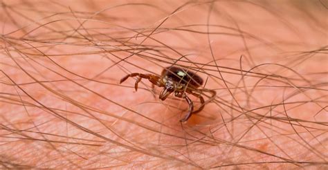 How to treat a tick bite and when to see a doctor | Oklahoma State ...