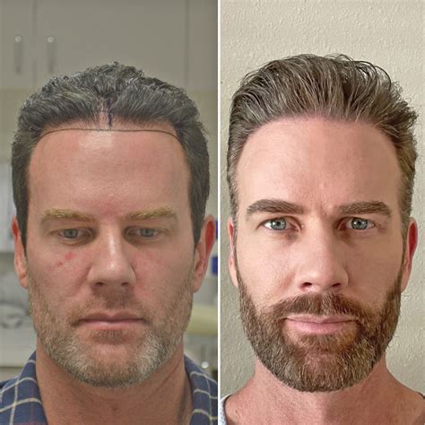 Manhattan Clinic Location | LA FUE NYC