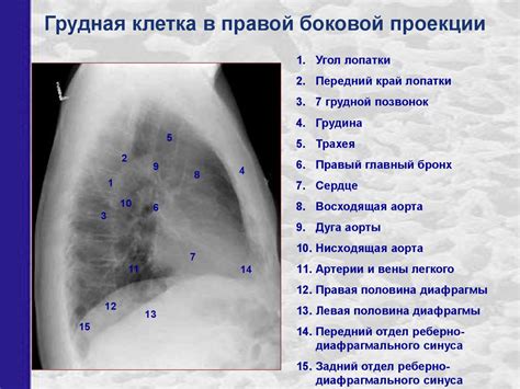 Рентгенанатомия грудной клетки - презентация онлайн