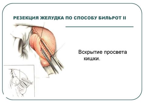 Голотопия желудка - презентация онлайн