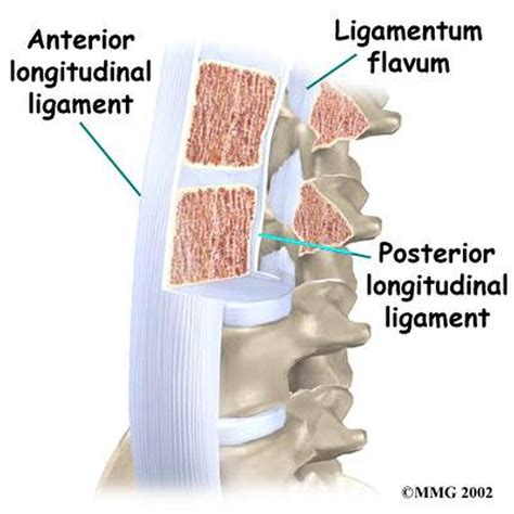 Pictures Of Anterior Longitudinal Ligament