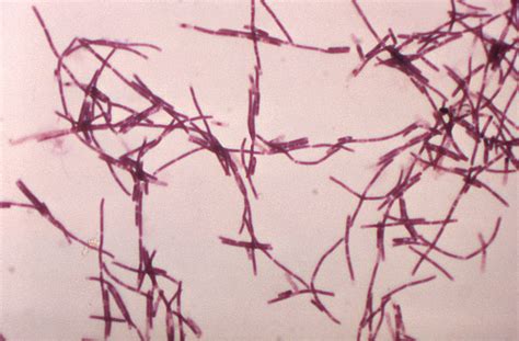 Free picture: gram, photomicrograph, numerous, bacillus anthracis, bacteria