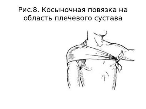 Презентация "Повязки на верхнюю конечность"