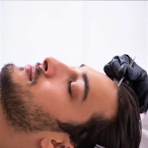 Surgical Hair Transplant - Sikara Clinics