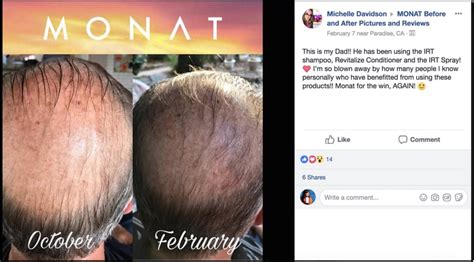 how to regrow hair male