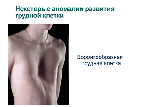 Диагностика хирургических заболеваний и повреждений грудной клетки и ...