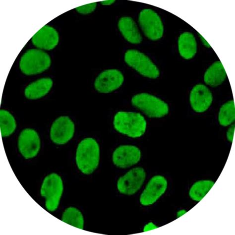 Immuno Concepts - Somagen Diagnostics