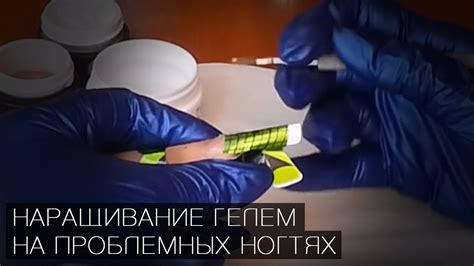 Наращивание гелем на проблемных ногтях (трапециевидные глубоко ...