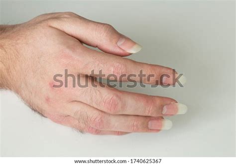 3+ Thousand Men With Long Nails Royalty-Free Images, Stock Photos ...