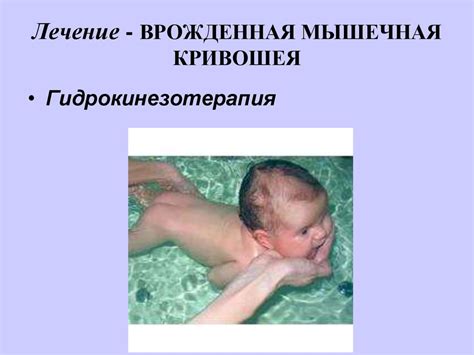 Кривошея - презентация онлайн