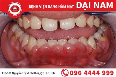 viem nha chu