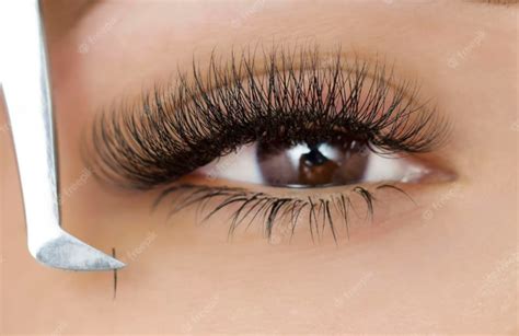 How to treat chemical burn in eye from eyelash extensions