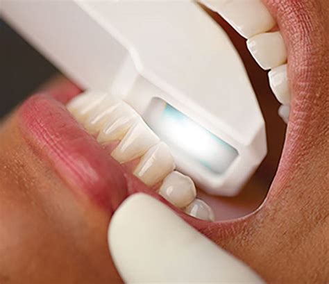 Цифровые технологии в стоматологии | DENTAL-INFO