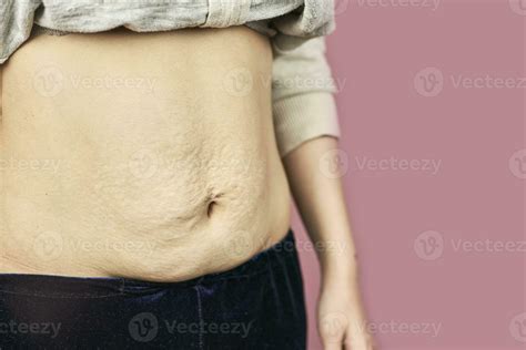 After birth Belly 31171249 Stock Photo at Vecteezy