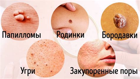 Если заметили непонятные пупырышки: 8 заболеваний, о наличии которых ...