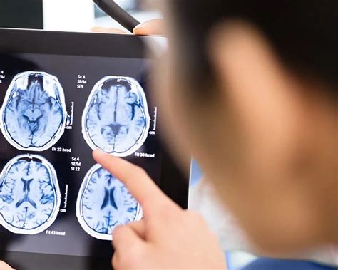 Headache Scans: CT vs. MRI - Which is the Better Option? - Blogs