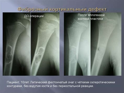 Дифференциальная диагностика опухолей и опухолеподобных процессов ...