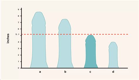 Elite Penis Girth and Size Surgery in Turkey 2024 | @istcurology