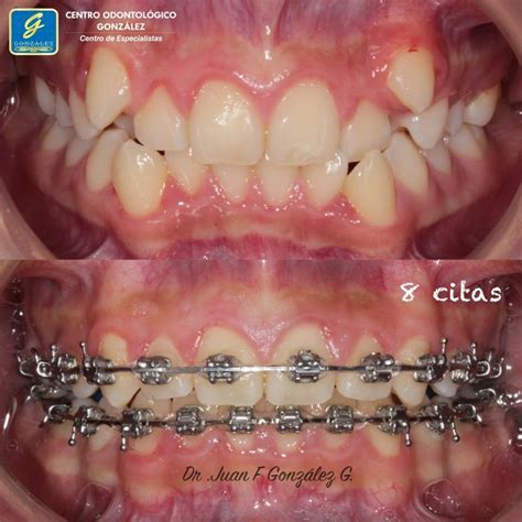 ortodoncista en cuenca certificado el mejor especialista
