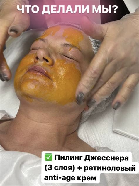 Пилинг Джесснера - Ощущения и изменения после манипуляций