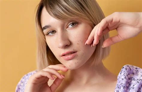 What is Hormonal Acne? What is the treatment plan? - Maysdermatology
