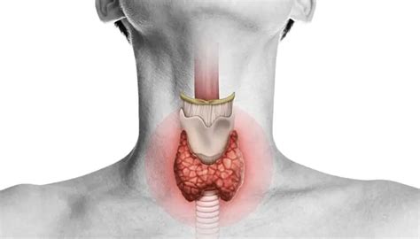 thyroid surgery  comprehensive guide  patients