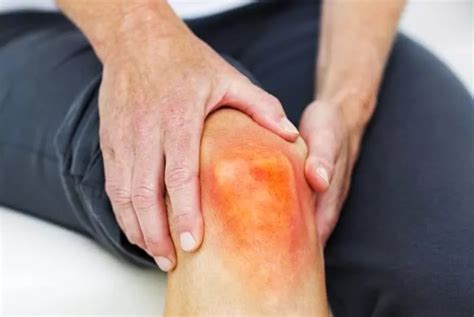 fakta penting seputar penyakit asam urat