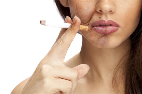Premature Skin Aging: Symptoms & Causes That You Should Know ...