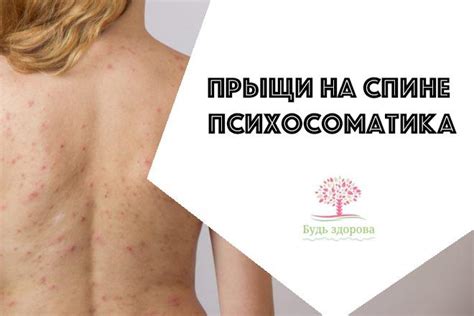 Прыщи на спине психосоматика вызывает у многих людей