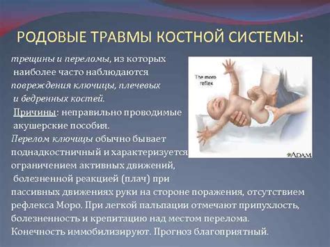 Презентация по педиатрии Тема родовые травмы новорожденных Работу