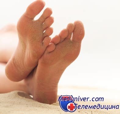 От чего немеет стопа? Причины онемения стопы