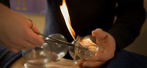 cupping melbourne acupuncture chinese medicinemelbourne acupuncture