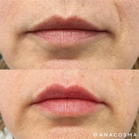 Какие бывают формы губ? – Блог ANACOSMA