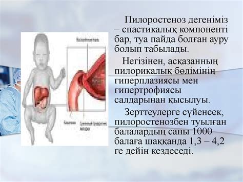 Пилоростеноз - презентация онлайн