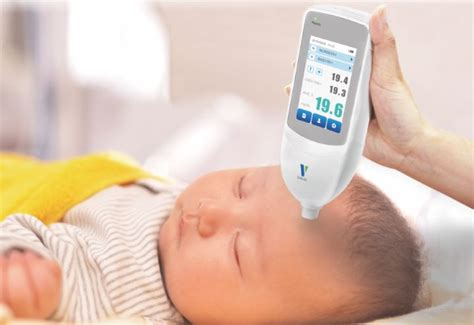 Handheld Bilirubin Meter - Regalmed | Medical Equipment in Dubai
