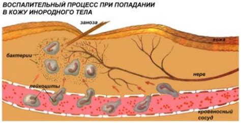 Базофилы в крови повышены причины у женщин. Причины у взрослых ...