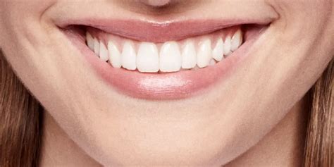 beautiful teeth treatment options costs