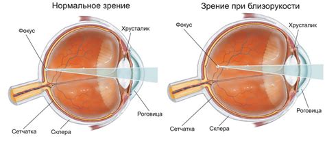 Упражнения для глаз при близорукости | Семья и ребенок