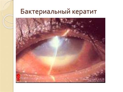 Болезни орбиты и глазодвигательного аппарата - презентация онлайн