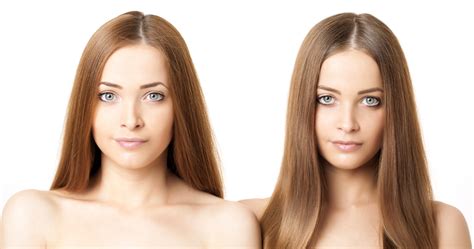 Causes et facteurs favorisant l’anorexie | Dossier