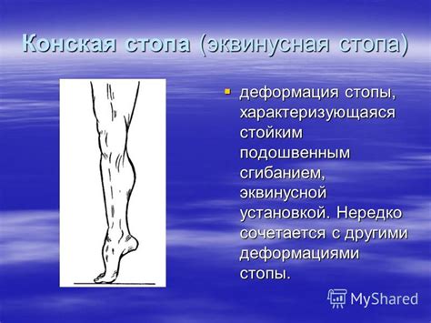 Презентация на тему: "ТЕМА 4. Кинетотерапия при ортопедических ...