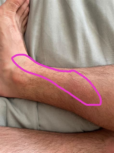 Ive notice a painful bump on the inside part of my right calf down to