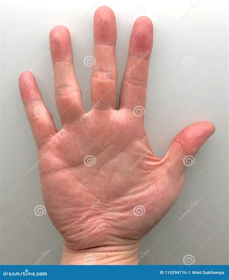 Right Palm with Palmar Creases and Fingers Stock Photo - Image of
