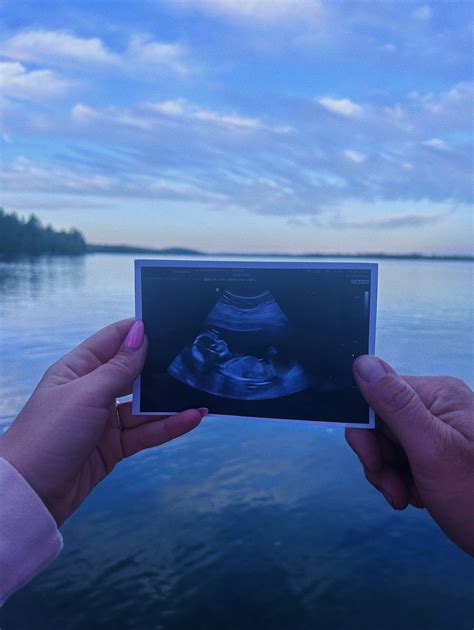 (@chelsea.wilde) • Instagram photos and videos