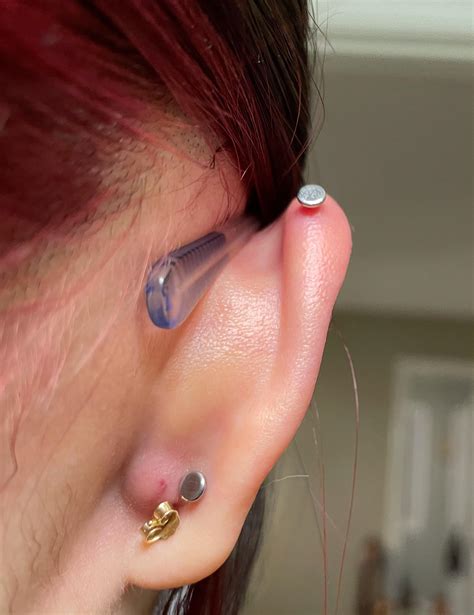Bump behind ear lobe? : r/PiercingAdvice
