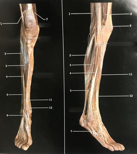 extensor hallucis longus cadaver