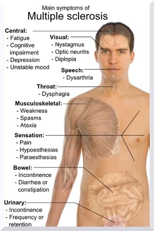 Multiple Sclerosis Symptoms