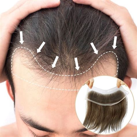 achieving  natural hairline  lavivid mens hair systems compreh
