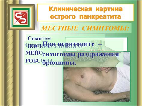 Острый панкреатит - презентация онлайн